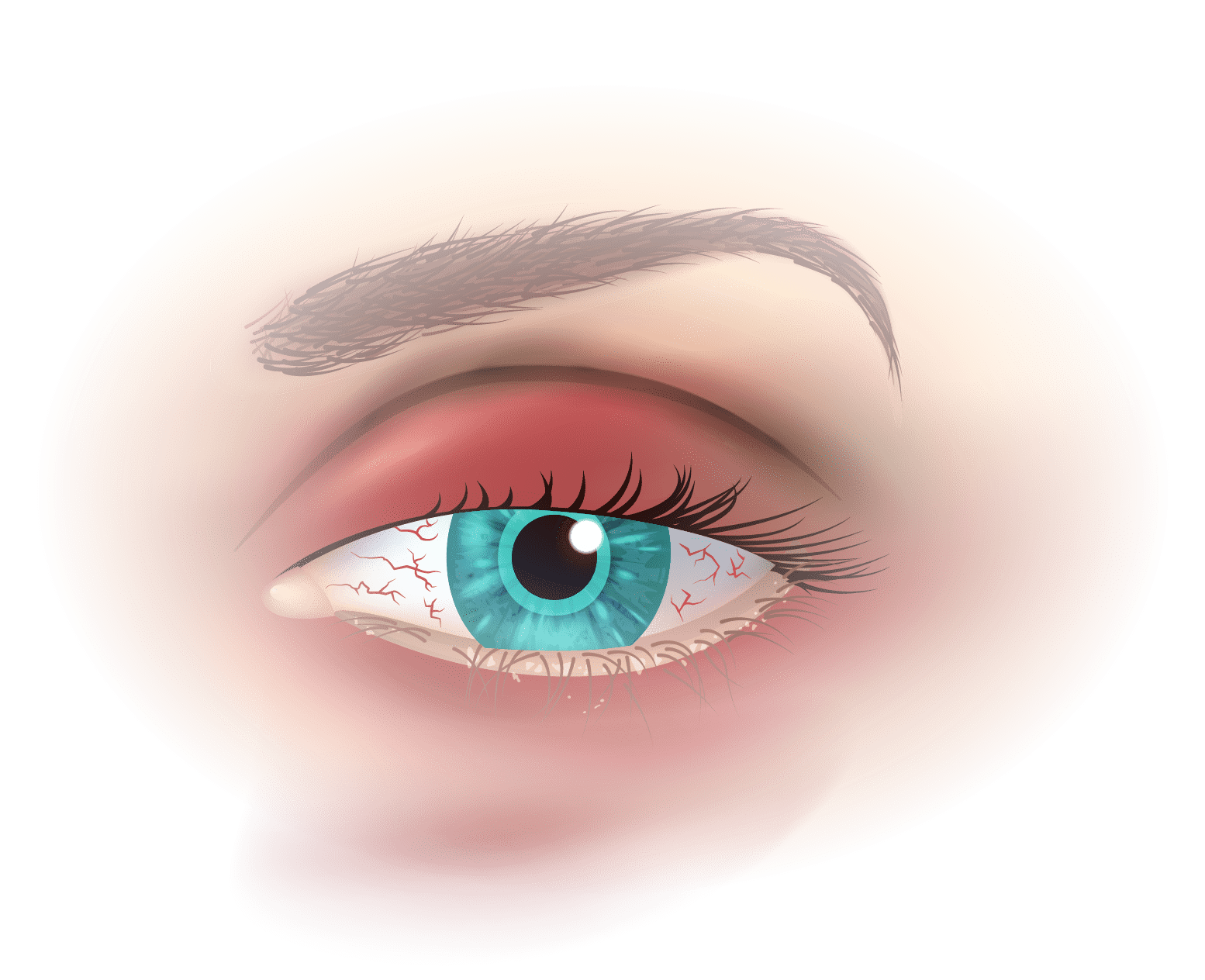 Diagnostic 2 Diagnostic en analyse clinique