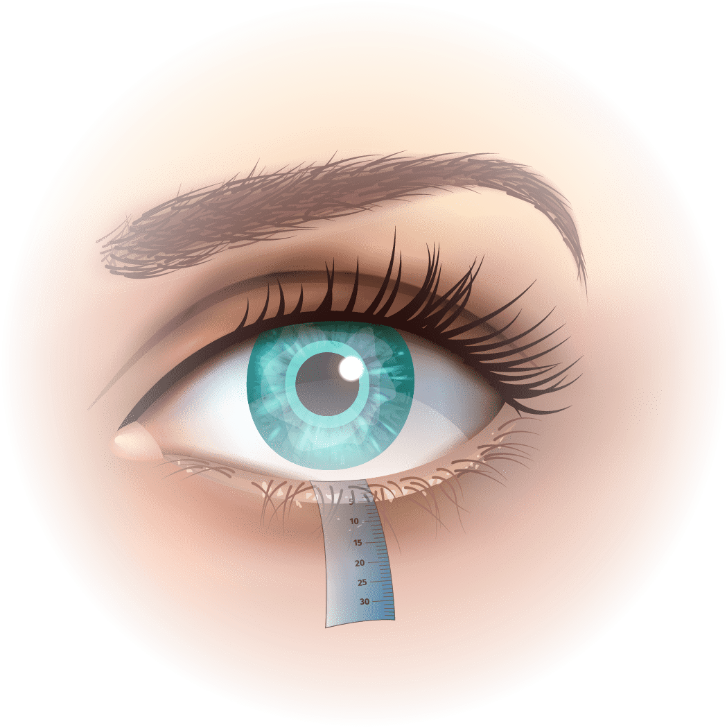 Diagnostic 3 test schirmer secheresse oculaire